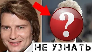 Невозможно узнать! Басков изуродовал себя на глазах у всех!