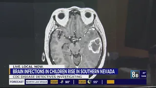 Clark County sees spike in rare brain infection, CDC says
