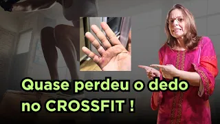 Ela quase perde o dedo no crossfit, por causa de uma infecção.