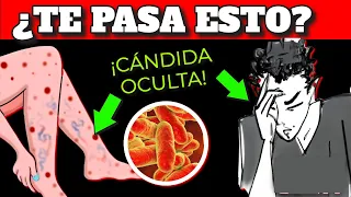 É IMPOSSÍVEL CURAR a CANDIDA SE NÃO SEGUIR ESTE CONSELHO| CANDIDÍASE