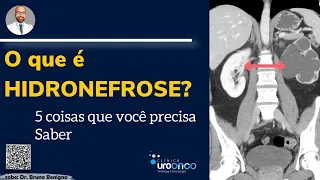 Hidronefrose pode ser grave? Qual a causa? Entenda o diagnóstico e tratamento em 5 perguntas