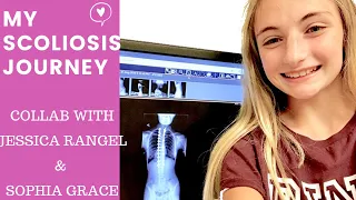 My Scoliosis Journey: Diagnosis, Bracing And Surgery!