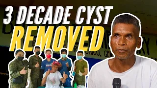 30-YEAR-OLD CYST REMOVED in Medical Mission