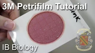 How to Use a Petrifilm Count Plate? - Biology Lab Techniques