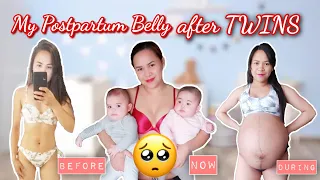 POSTPARTUM BELLY AFTER HAVING TWINS (5months) | HOW I DEAL WITH POSTPARTUM DEPRESSION?