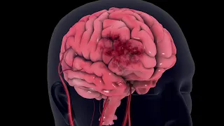 Stroke - 3d animation