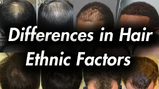 Differences in Hair: Ethnic Factors and Hair Loss