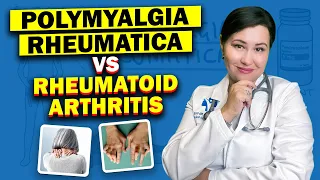 Polymyalgia Rheumatica vs Rheumatoid Arthritis - Uncovering the Similarities and Differences