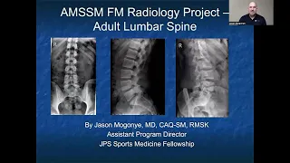 Lumbar Spine | MSK Radiology: X-Ray Educational Modules for Primary Care Residents