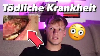 Ich habe eine TÖDLICHE KRANKHEIT !😳