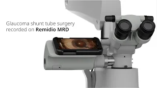 Remidio MRD: Glaucoma Shunt Tube Surgery