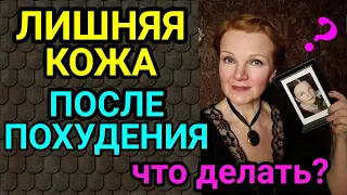 лишняя кожа после похудения / как я похудела на 94 кг и улучшила здоровье