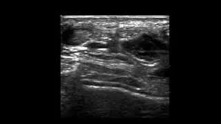 Musculoskeletal Ultrasound: Ankle 2: anterior transverse scan