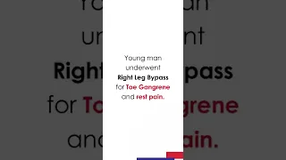 Right Leg Bypass For Toe Gangrene | Dr. Vijay Thakore