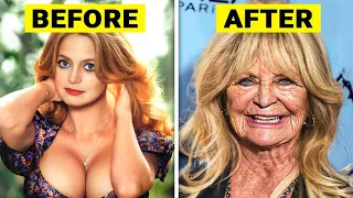 25 Celebrities Who Have Aged Terribly