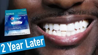 Crest 3D Whitestrips 2 Years Later: How to Whiten Teeth EASY!