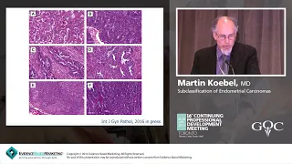 Subclassification of Endometrial Carcinomas - Martin Koebel