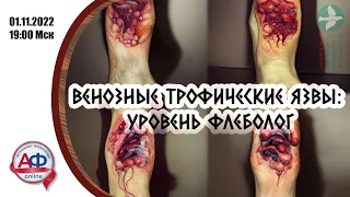 Венозные трофические язвы: уровень флеболог