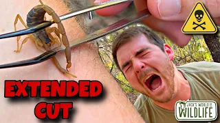 STUNG By A BARK SCORPION! The EXTENDED CUT!