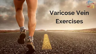 Varicose Vein Exercises
