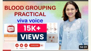 ABO BLOOD GROUPING VIVA VOICE- ultra important viva questions✅✅pathology practical