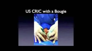 UltrasoundPodcast.com - Ultrasound Assisted Cricothyrotomy