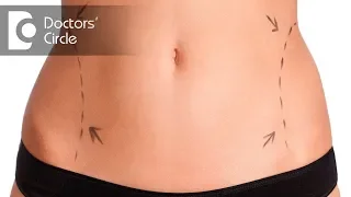 Can one get rid of cellulite with Liposuction? - Dr. Pavithra H N