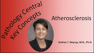 Medical School Pathology: The Pathophysiology of Atherosclerosis