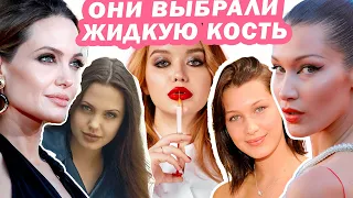 ЖИДКАЯ КОСТЬ - ЛУЧШИЙ ПРЕПАРАТ ДЛЯ ИНЪЕКЦИЙ? ГИДРОКСИАПАТИТ КАЛЬЦИЯ vs ПОЛИМОЛОЧКА